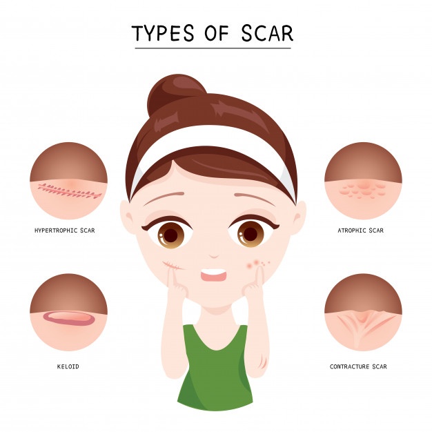 626x626 Scar Vectors, Photos And Free Download