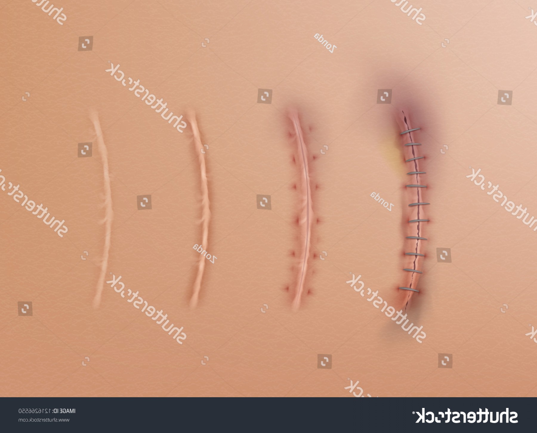 1800x1452 Vector Scarring Stiches Hoodamathrun