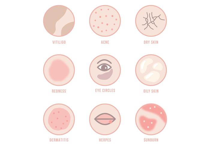Skin Condition Vectors 700x490 Skin Condition Vectors
