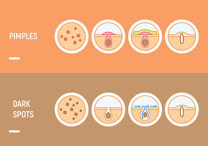 Skin Free Vector Art 700x490 Skin Free Vector Art