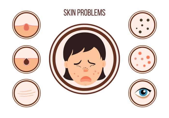 Female With Skin Problems Vector 700x490 Female With Skin Problems Vector
