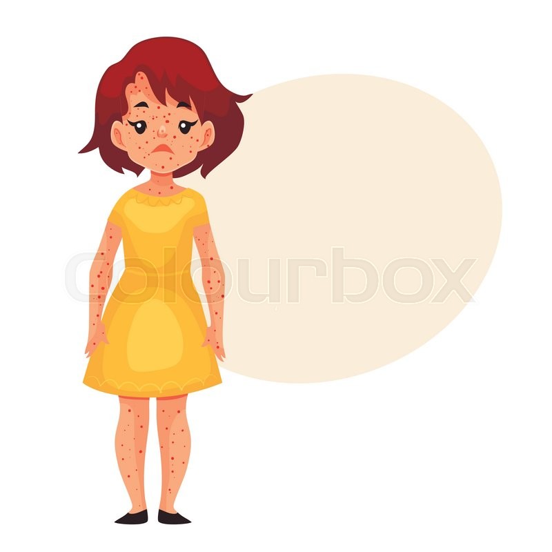 800x800 Little Girl Having Chickenpox, Cartoon Stock Vector Colourbox