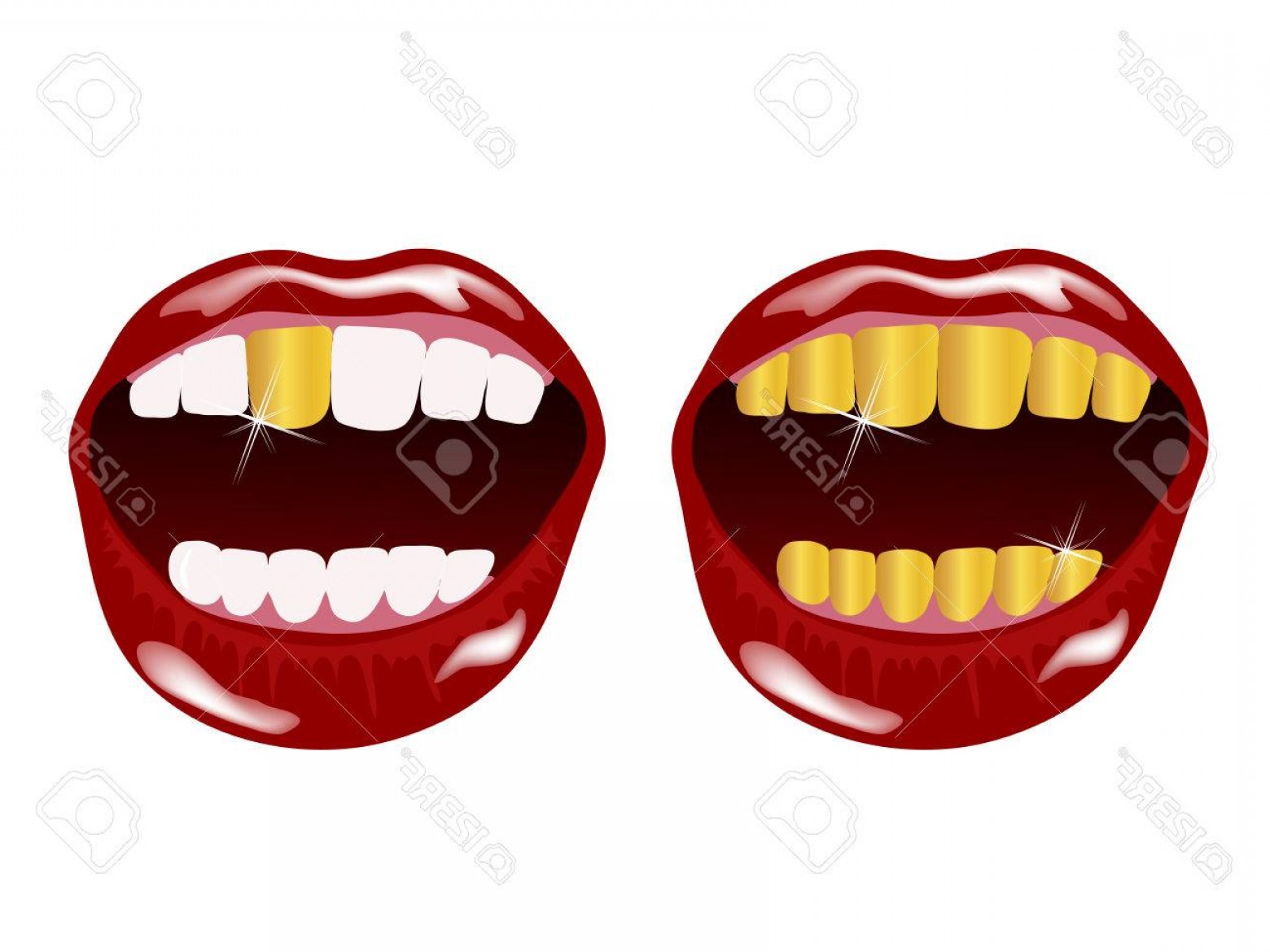 1560x1170 Photostock Vector Woman Smile With Golden Teeth Newwaysys