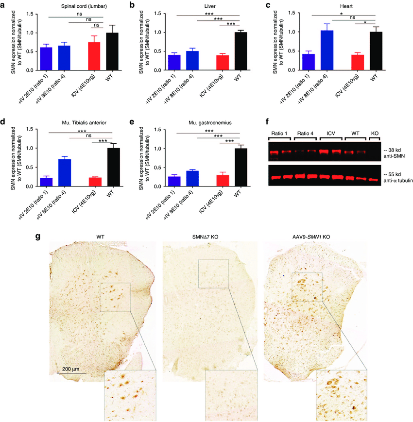850x869 Smn Protein Localization In The Spinal Cord Three Months After