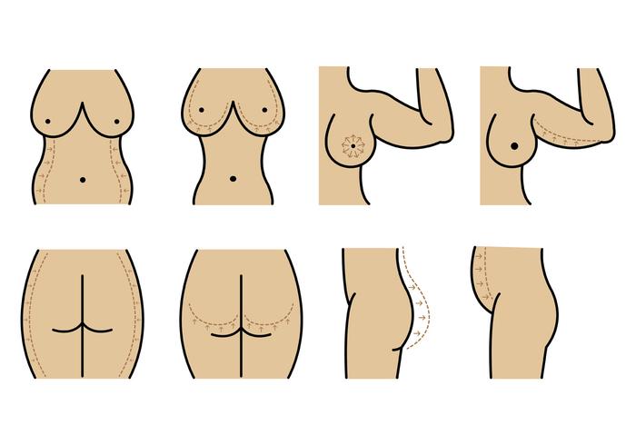 Set Of Plastic Surgery Vector 700x490 Set Of Plastic Surgery Vector