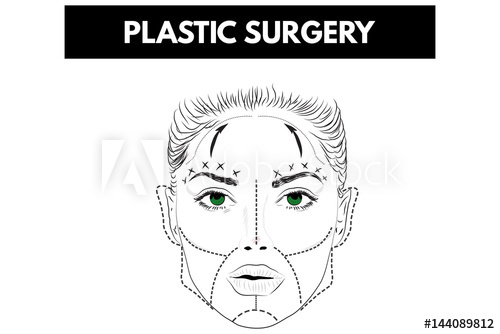 Woman Face With Red Lines Plastic Surgery Vector Illustration 500x334 Woman Face With Red Lines Plastic Surgery Vector Illustration