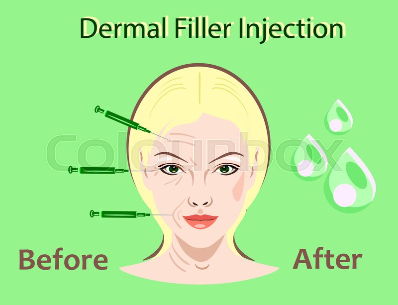 Cosmetic Surgery Vector Illustration Stock Vector Colourbox 800x613 Cosmetic Surgery Vector Illustration Stock Vector Colourbox