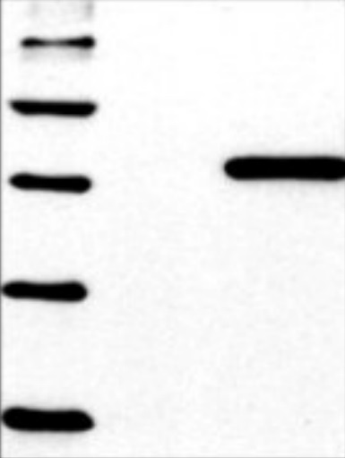 385x511 His Tag Mouse Monoclonal Antibody