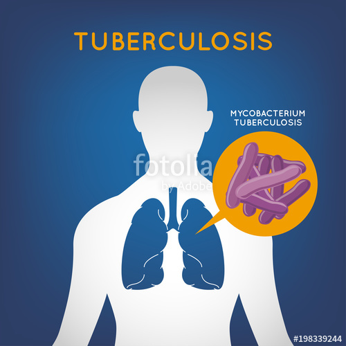 500x500 Tuberculosis Vector Logo Icon Illustration Stock Image
