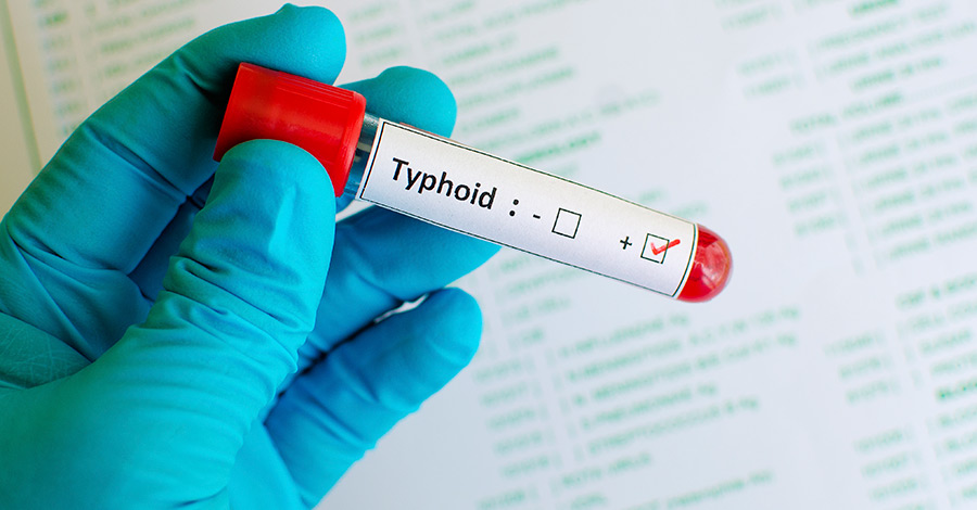 900x470 Typhoid And Typhus, What's The Difference Passport Health