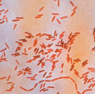 303x299 Infection Landscapes Typhoid Fever