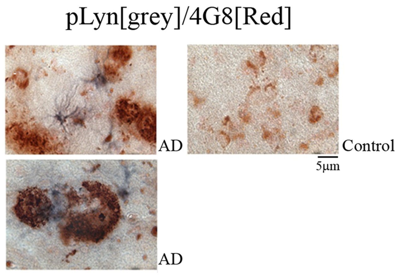 1295x901 Abc Kit For Visible Chromogen Kitreagent Review