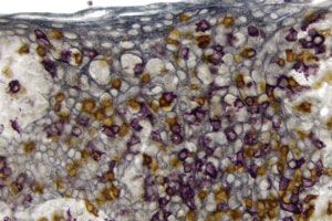 300x200 Sg Peroxidase