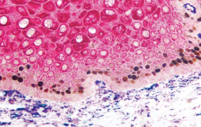 695x440 Choosing A Abc Kit