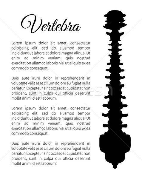 Backbone Stock Vectors, Illustrations And Cliparts Stockfresh 476x600 Backbone Stock Vectors, Illustrations And Cliparts Stockfresh