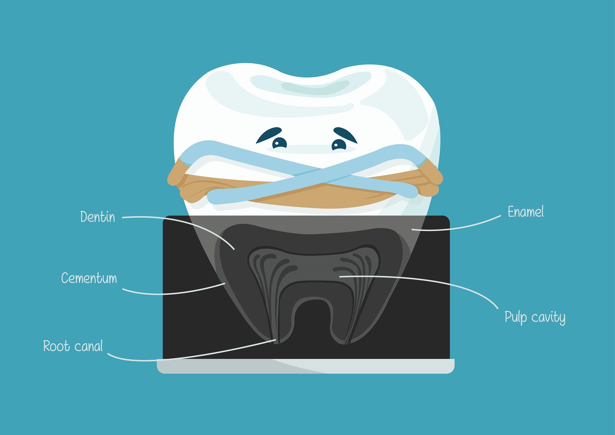2000x1413 Root Canal Dental Vector