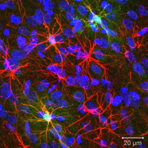 300x300 Reissner Lab Resources