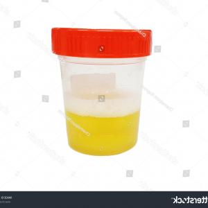 300x300 Urine Test Laboratory Equipment Urinalysis Yellow Soidergi