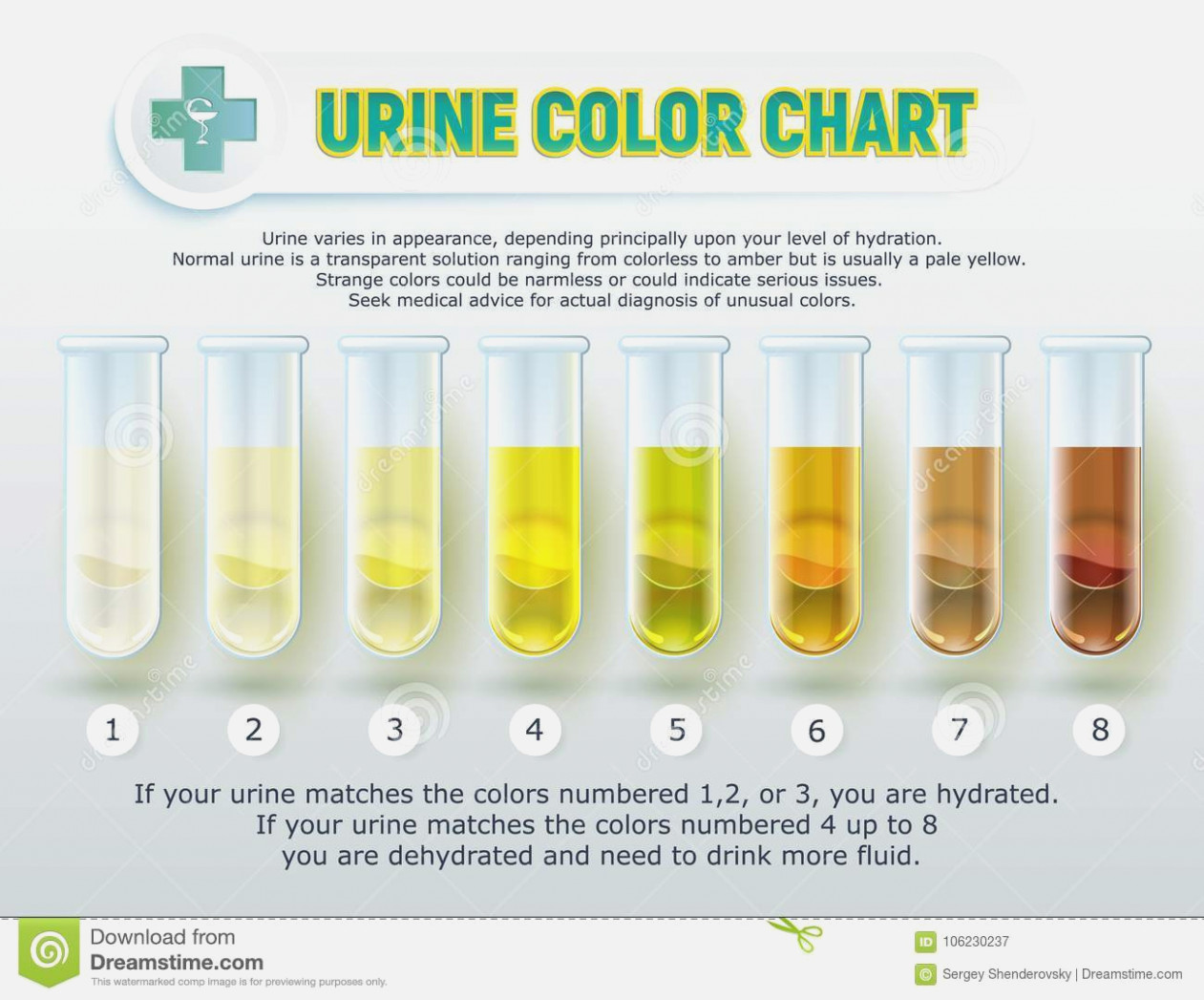 1261x1047 Urine Test Strips Color Chart Fresh Urine Color Chart Stock