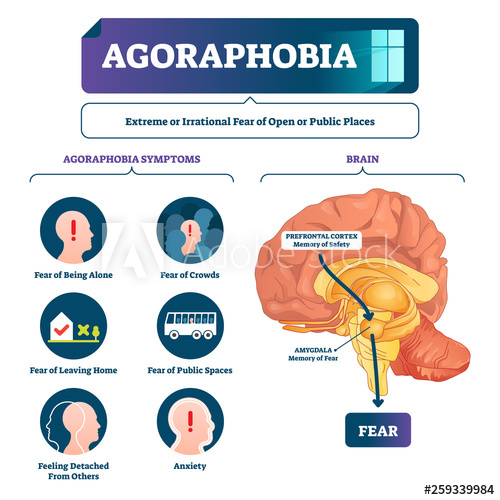 Agoraphobia Vector Illustration Labeled Anatomical Fear 500x500 Agoraphobia Vector Illustration Labeled Anatomical Fear