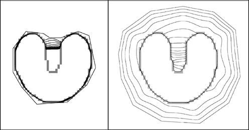 496x260 Gradient Vector Flow Springerlink