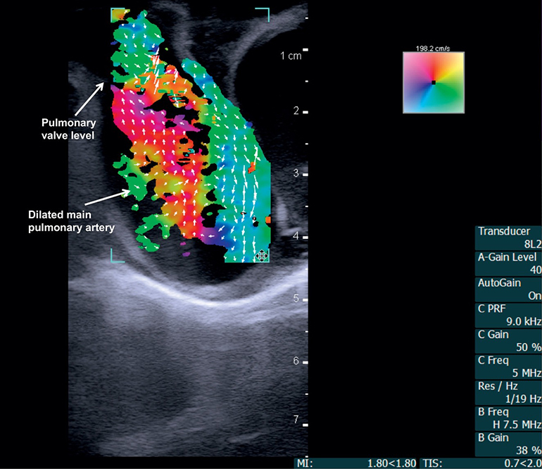 770x666 Vector Flow Imaging Used To See Blood Flow In Humans For First