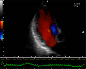 300x240 Vector Flow Mapping
