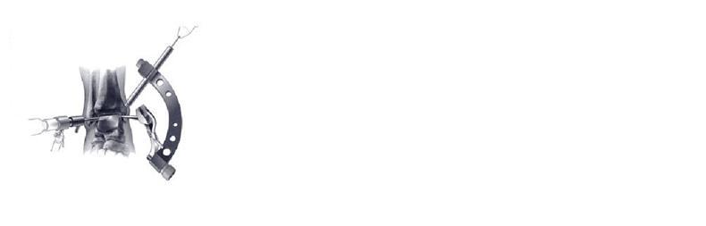 Micro Vector Drill Guide System Smith Nephew 790x253 Micro Vector Drill Guide System Smith Nephew