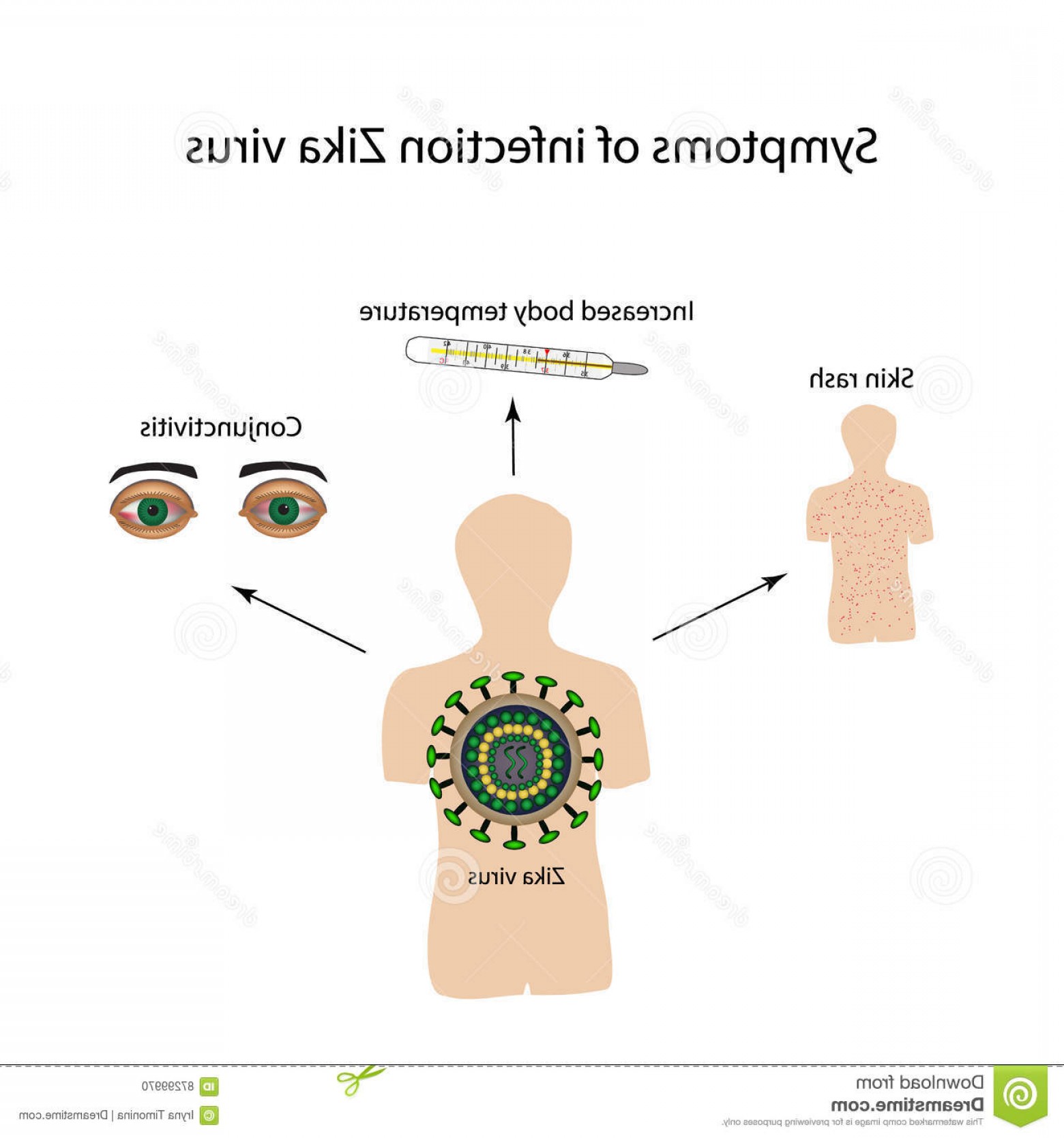 1560x1668 Stock Illustration Zika Virus Symptoms Infection Infographics