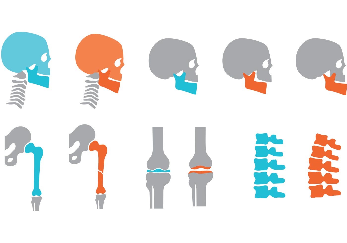 1400x980 Orthopedic Bones And Joints Vectors