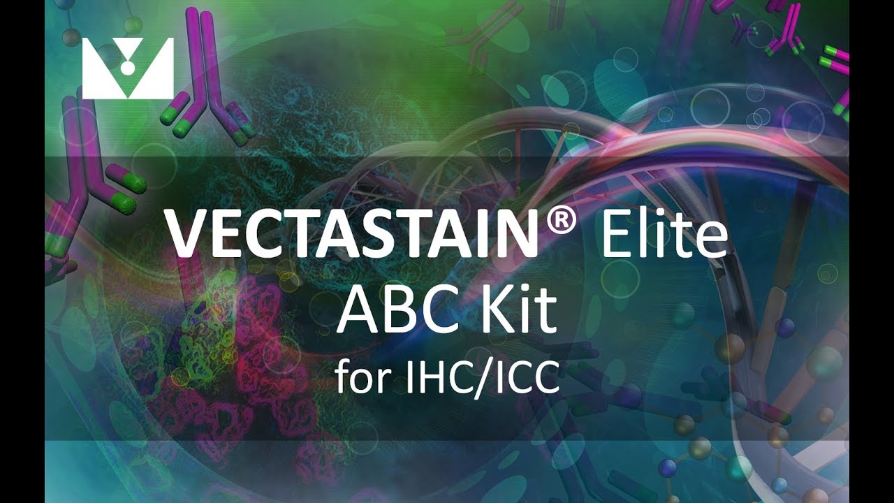 1280x720 Detection With Vectastain Elite Abc Kit From Vector Laboratories