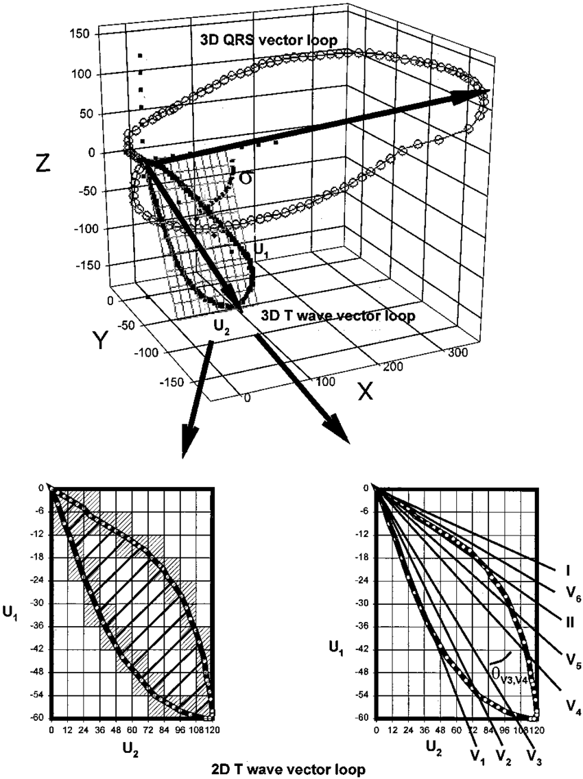 Schematic Dimensional View Of Qrs And T Wave Vector Loops Main 850x1136 Schematic Dimensional View Of Qrs And T Wave Vector Loops Main