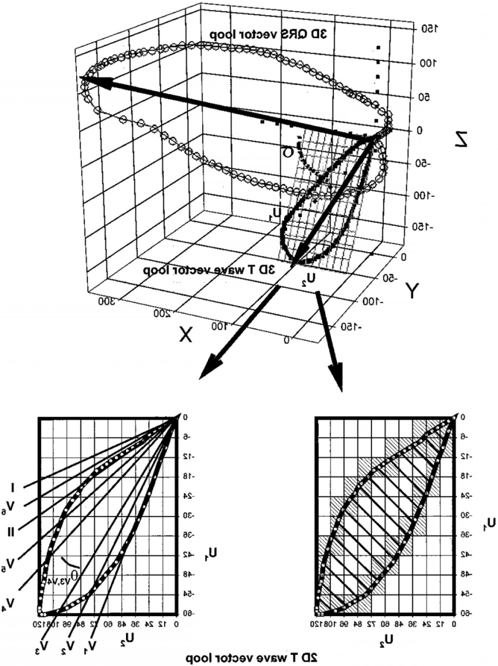 Schematic Dimensional View Of Qrs And T Wave Vector Loops Main 1020x1363 Schematic Dimensional View Of Qrs And T Wave Vector Loops Main