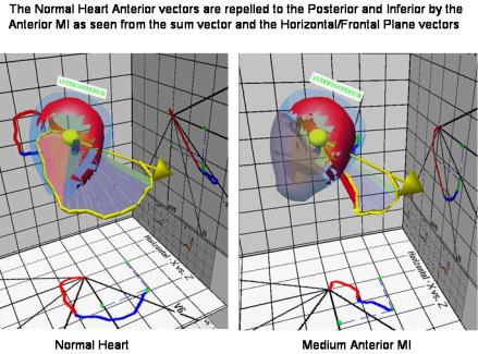 The Ecg In Heart To Loop To Leads 439x325 The Ecg In Heart To Loop To Leads