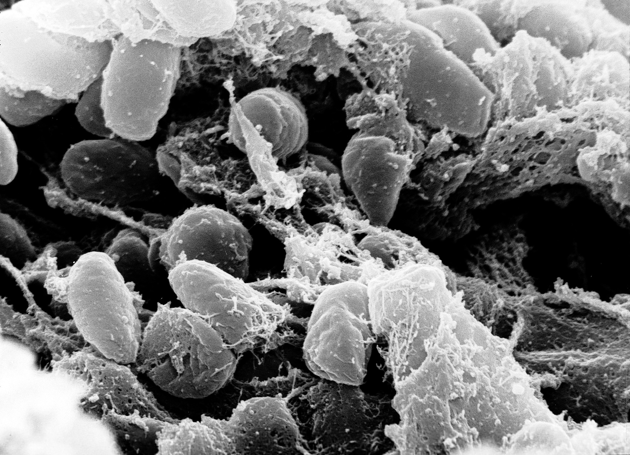 2092x1512 Yersinia Pestis