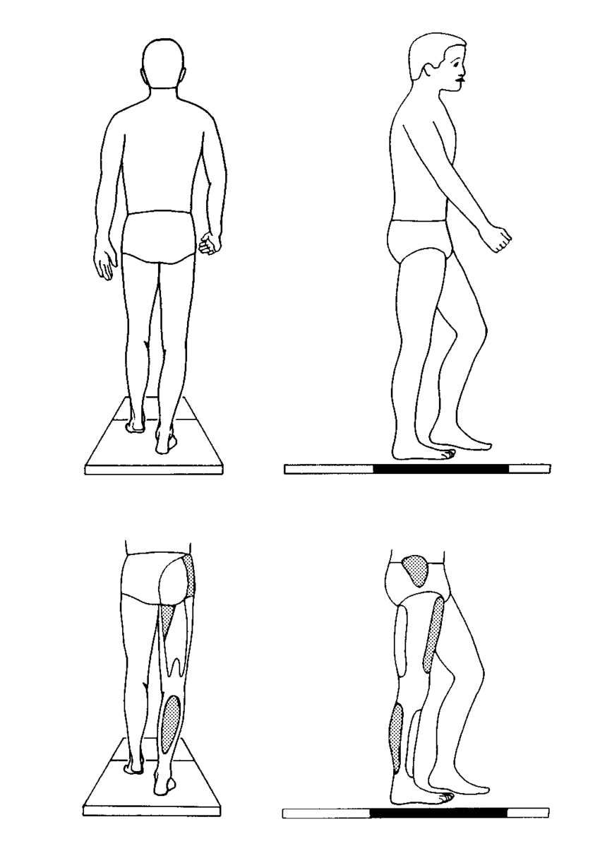 850x1215 Figure Unit Vector Reference Frames Embedded In The Proximal