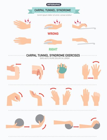 345x450 Carpal Tunnel Syndrome Infographic,vector Illustration Royalty