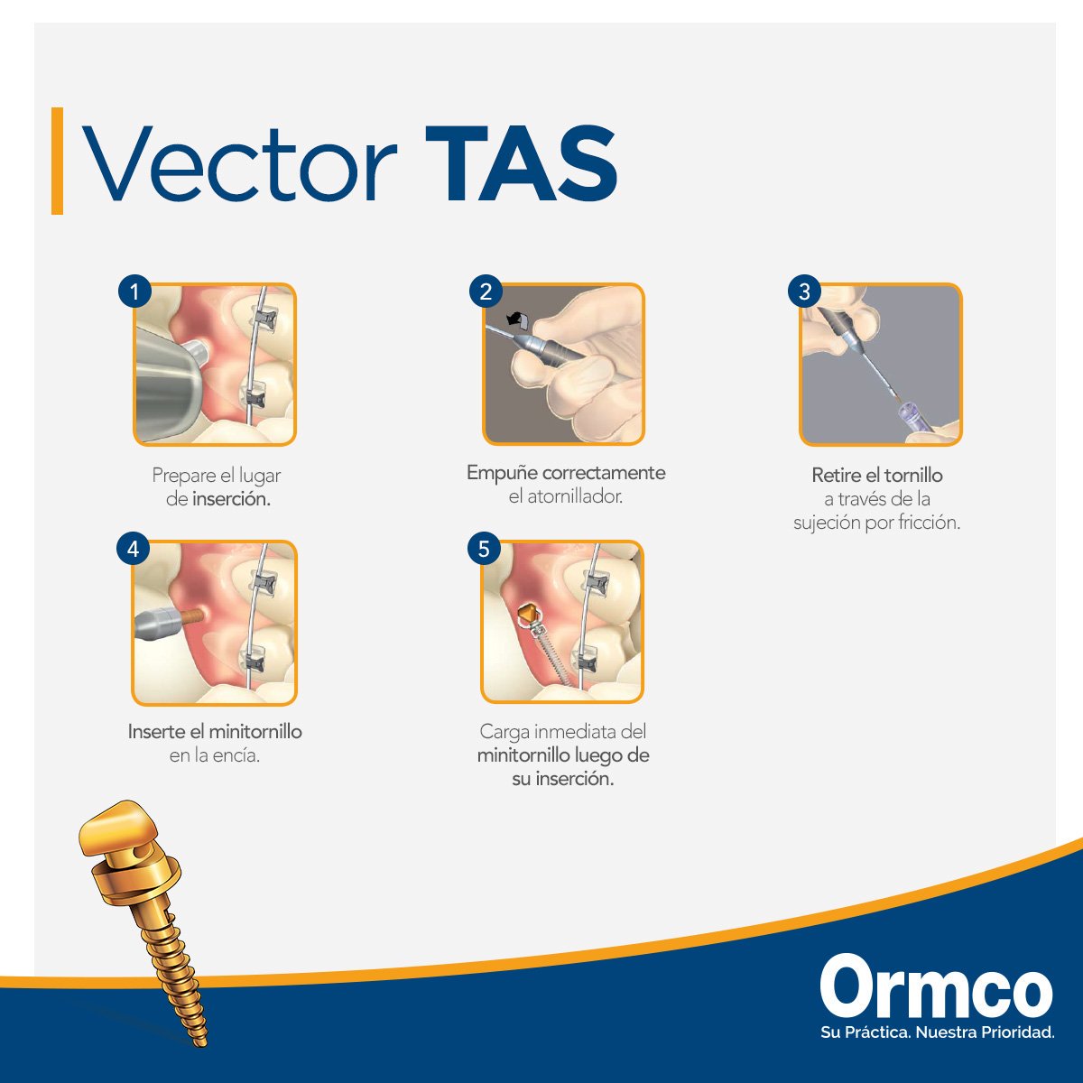 1200x1200 Ormco Mx Haga Anclajes Temporales De Manera Eficaz Con