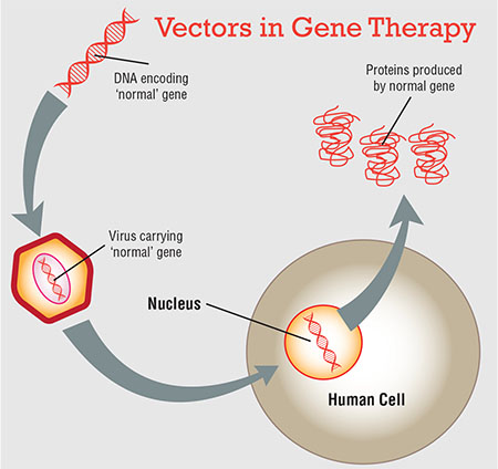 450x424 Gene Therapy The New Frontier For Inherited Retinal Disease