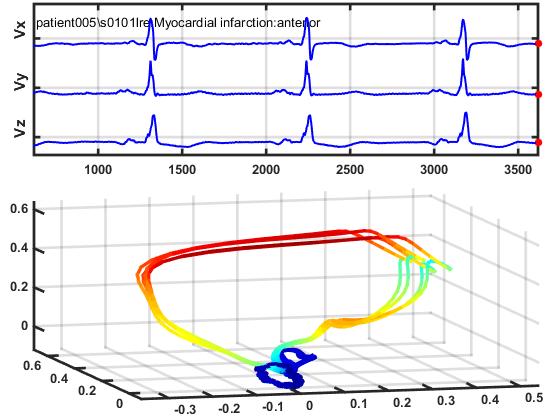 560x420 Pdf Spatiotemporal Representation Of Cardiac Vectorcardiogram