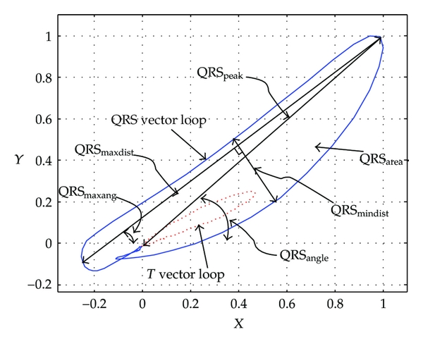 600x491 Personal Identification Based On Vectorcardiogram Derived