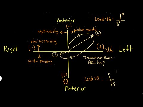Schneid Guide To The Qrs Vectorcardiogram Loop 480x360 Schneid Guide To The Qrs Vectorcardiogram Loop