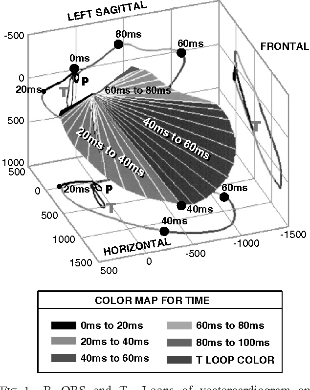 634x798 Significance Of Vectorcardiogram In The Cardiological Diagnosis