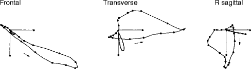 488x136 The Normal Electrocardiogram And Vectorcardiogram Springerlink