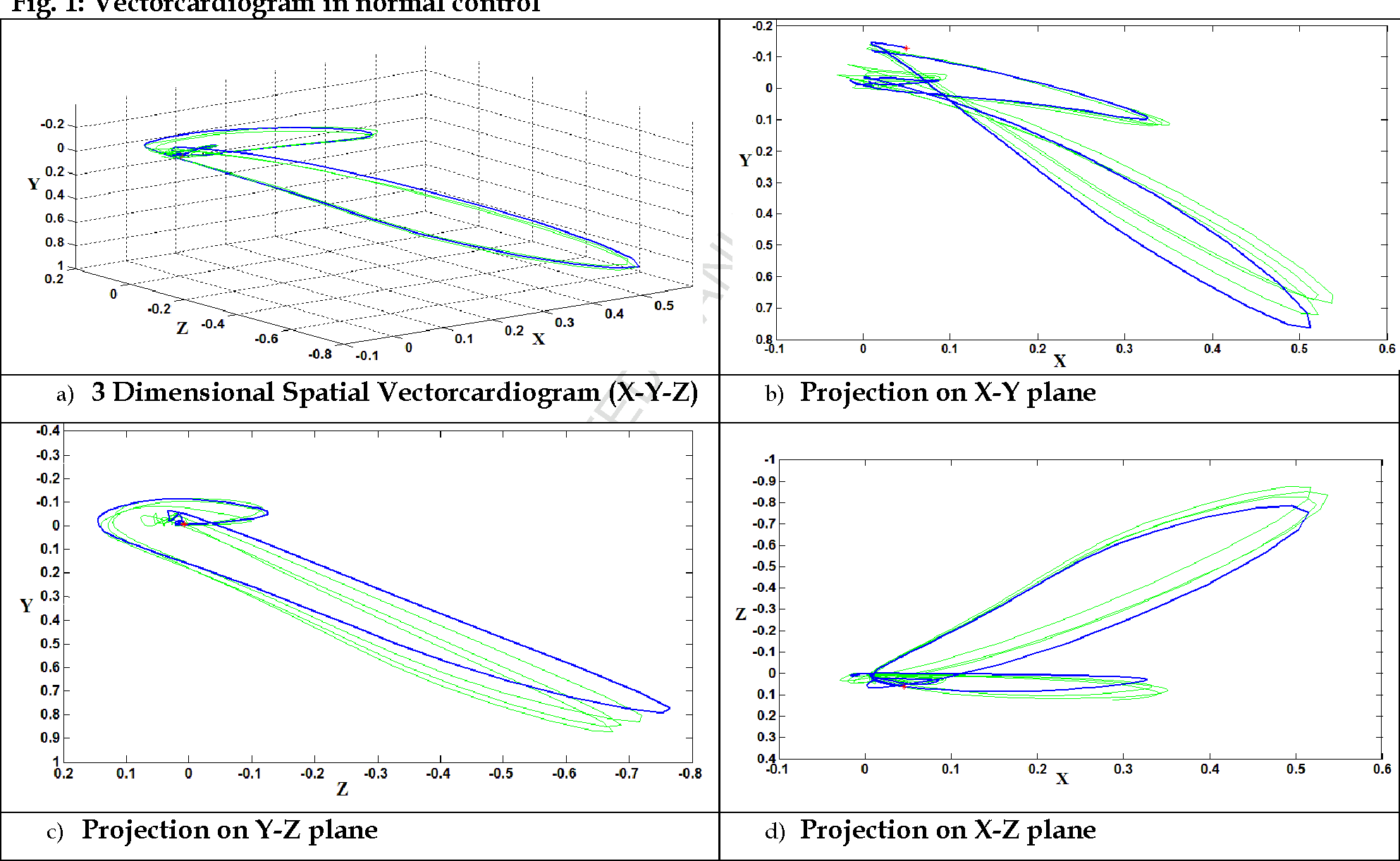 An Evaluation Of Planarity Of The Spatial Qrs Loop 1986x1222 An Evaluation Of Planarity Of The Spatial Qrs Loop