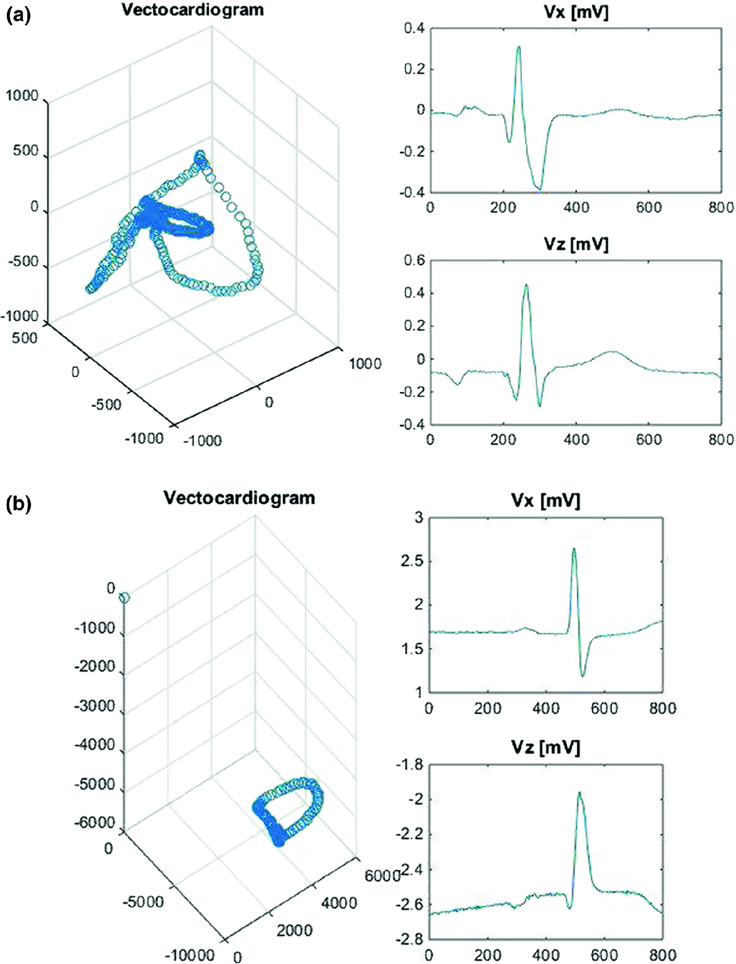 1508x1975 Vectorcardiogram Elearning Application Springerlink