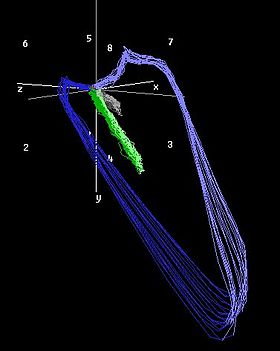 280x351 Vectorcardiography