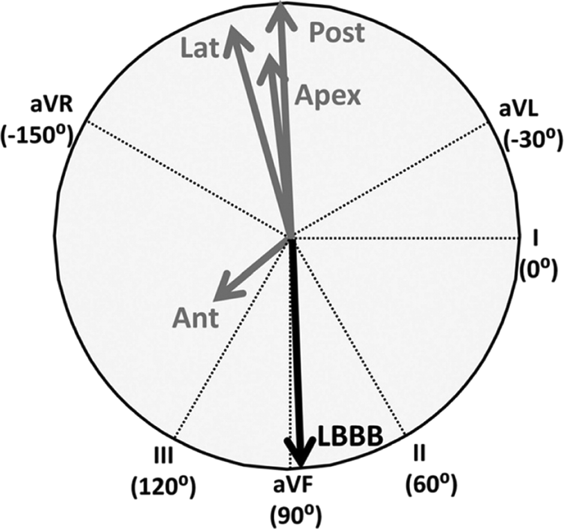 1800x1688 Vectorcardiography As A Tool For Easy Optimization Of Cardiac