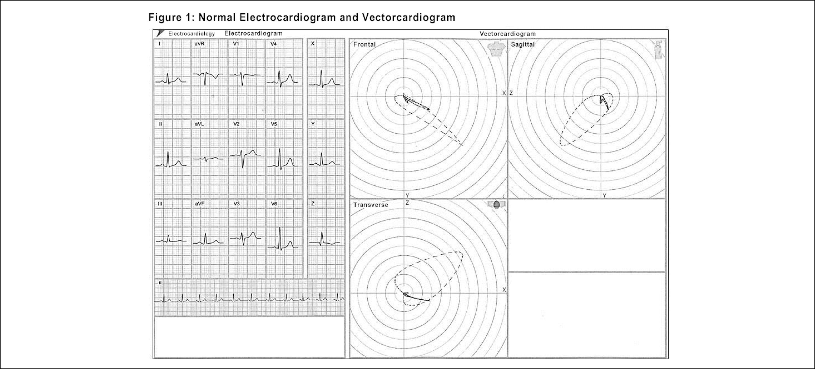 2700x1224 Applicability Of The Electro Vectorcardiogram In Current Clinical