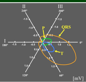 284x270 Electrocardiogramvectorcardiogram